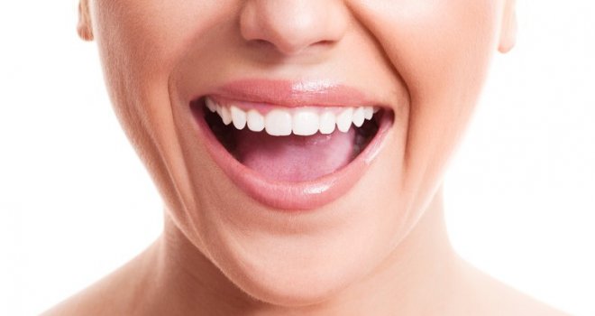 Ne morate kod zubara: Pet načina da uklonite zubni kamenac kod kuće!