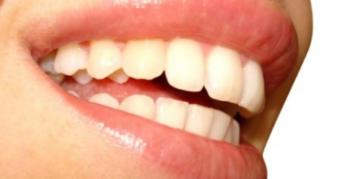 Upozorenje zubara: Sedam namirnica koje biste trebali izbjegavati i zubi će vam biti zahvalni!