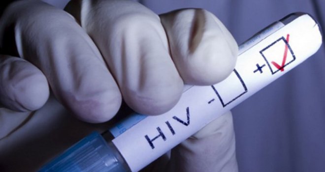 Alarmantni podaci sa KCUS-a: Otkriveno 20 novih slučajeva infekcije HIV-om!