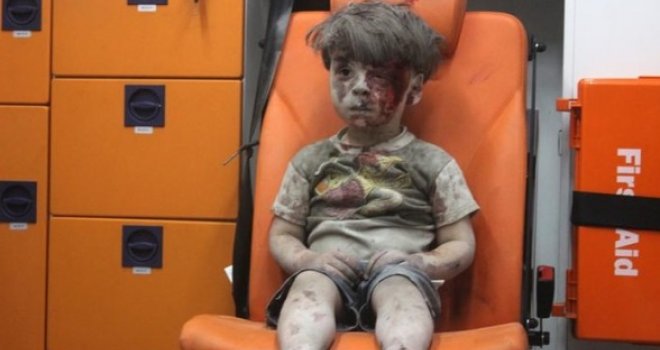 Priče od kojih se slama srce: Slika sirijskog dječaka Omrana - simbol jezive sudbine miliona unesrećene djece