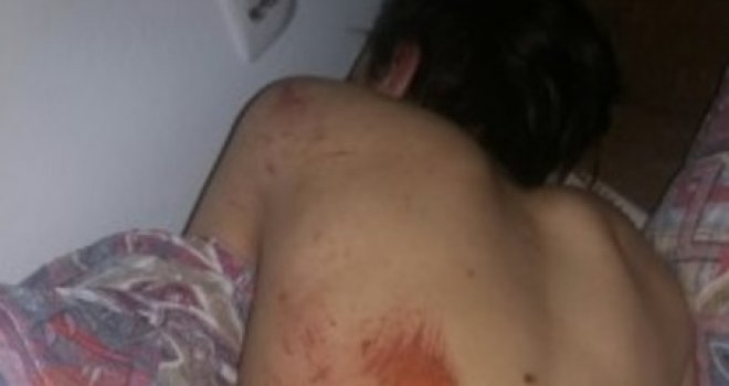Uhapšeni osumnjičeni za brutalni napad u Tesliću: Mladiću ošišali kosu i bradu, tukli ga i vezali za auto