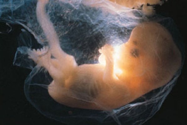 fetus