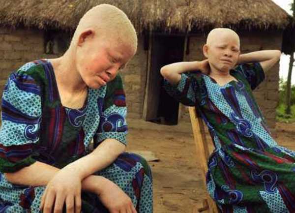 albino crnci