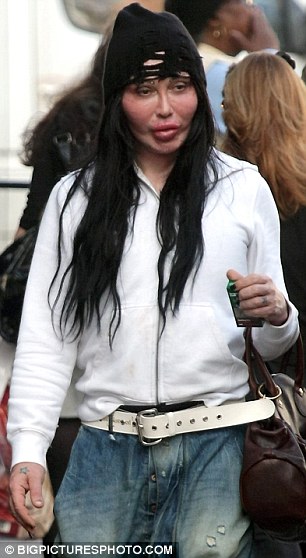 pete burns