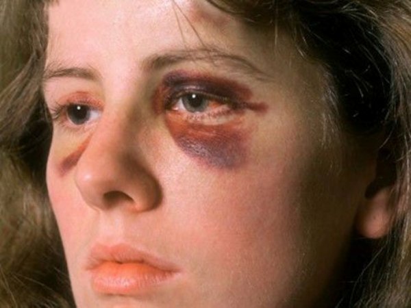 Fejsbuk grupa Smrt ženama