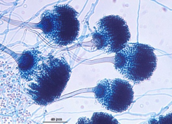 Aspergillus fumigatus