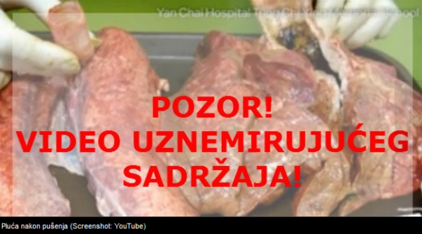 pluća nakon 60 ispušenih cigareta