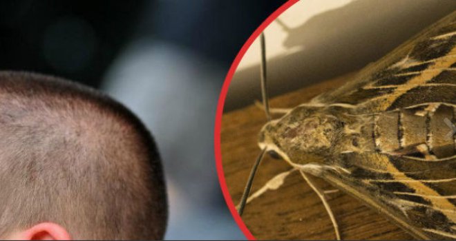 Zbog zujanja u ušima otišao kod ljekara. Ono što su pronašli, šokiralo ih je!