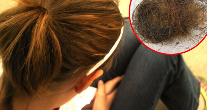 Djevojčicu dugo bolio stomak, ono što su u njemu otkrili zaprepastilo je sve