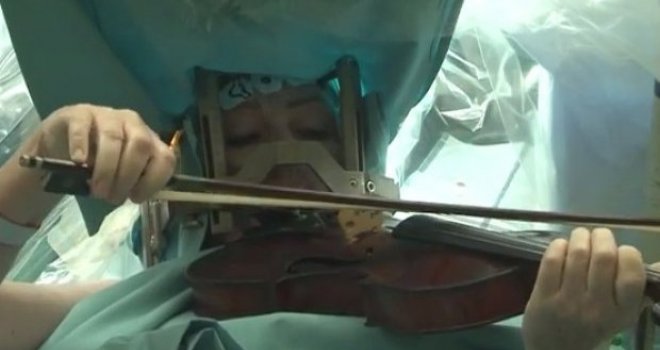 Svirala violinu dok su joj operisali mozak!