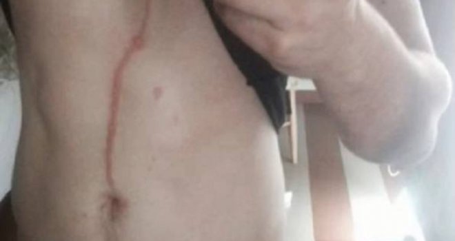 Oitšao na odmor na Bali, a ono što je po povratku pronašao u svom tijelu će vas potpuno šokirati
