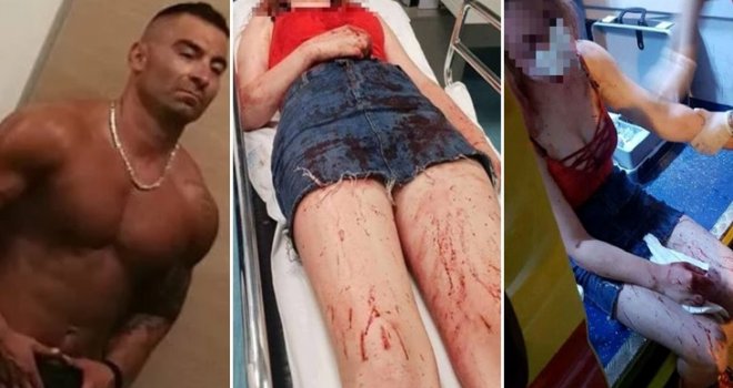Djevojka koju je brutalno premlatio Darko Kovačević 'Daruvarac' izašla u javnost: Vlasnica je konobarici rekla da ne zove policiju i hitnu