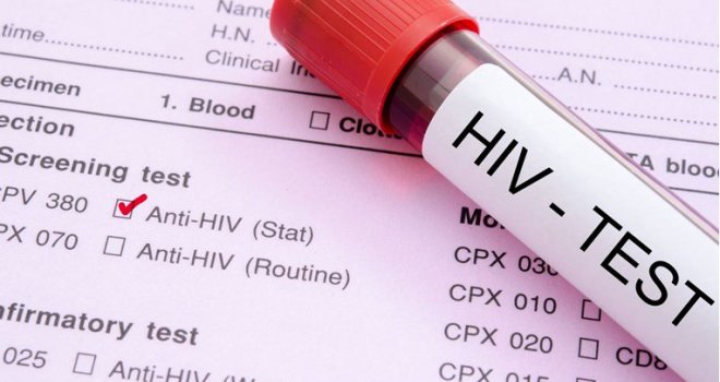 Kraj epidemije AIDS-a na vidiku: HIV pozitivni ne mogu zaraziti partnere ako uzimaju lijekove!