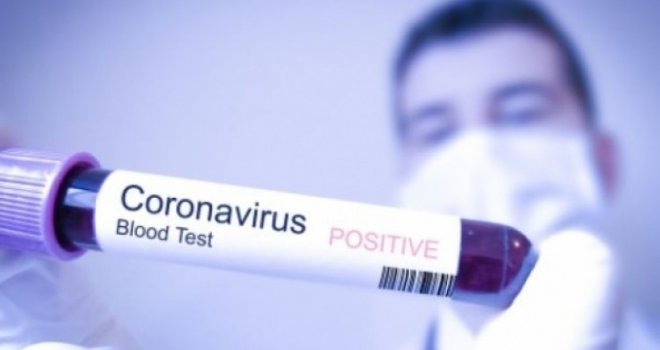 Ovo su simptomi: Kada treba posumnjati da ste zaraženi korona virusom?
