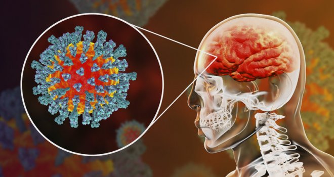 Kako koronavirus utiče na mozak i nervni sistem? 'Ako postanete zbunjeni, javite se ljekaru'