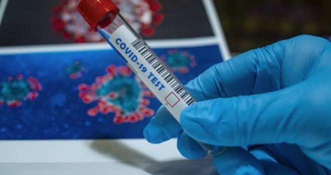 U Hrvatskoj zabilježena dva slučaja zaraze južnoafričkim sojem koronavirusa