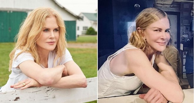 Fanovi iznenađeni: Šta se sad dogodilo s licem Nicole Kidman?