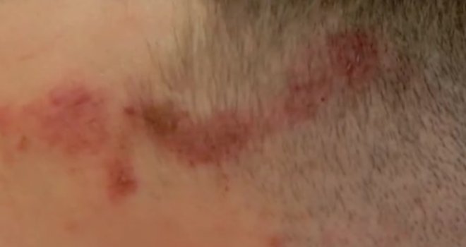 'Ovo je nezapamćen teror policije': Snimci demantuju tvrdnje Dačića i Vučića, među pretučenima i maloljetnici